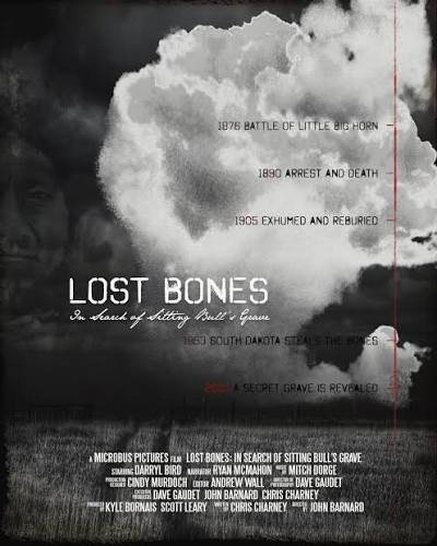 Lost Bones